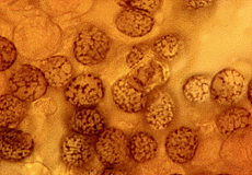 Lactarius piperatus spore